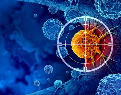 Lavelle Partners Secures Settlement for Client whose Wife Died due to a Delayed Cancer Diagnosis