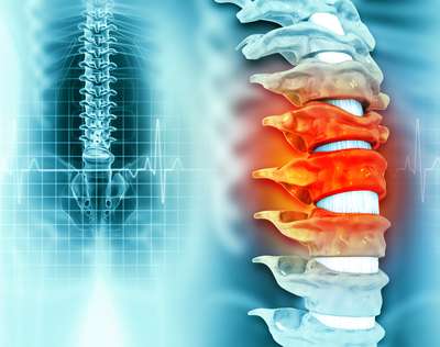 Temple Street Scoliosis Surgeries Controversy: HIQA Publishes Report 