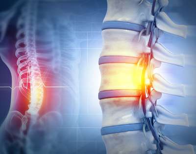 Spinal Injury Claims: A Step-by-Step Guide